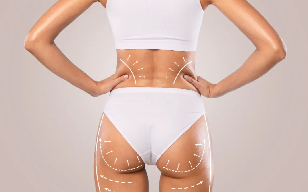 How to Maintain Your Brazilian Butt Lift Results:  Expert Tips from a Beverly Hills Plastic Surgeon